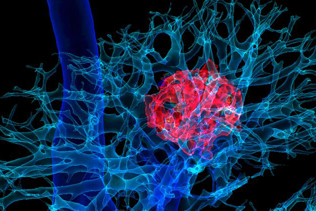 3D CT Scan